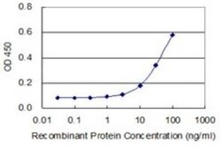 ILK Antibody (4F10), Novus Biologicals 0.1 mg | Buy Online | Novus Biologicals | Fisher Scientific