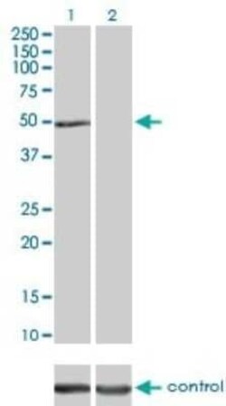 ILK Antibody (4F10), Novus Biologicals 0.1 mg | Buy Online | Novus Biologicals | Fisher Scientific