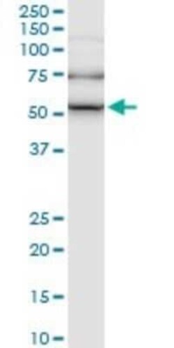 ILK Antibody (4F10), Novus Biologicals 0.1 mg | Buy Online | Novus Biologicals | Fisher Scientific