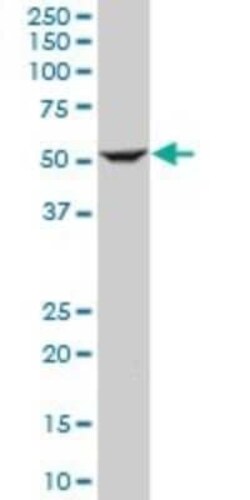 ILK Antibody (4F10), Novus Biologicals 0.1 mg | Buy Online | Novus Biologicals | Fisher Scientific