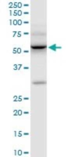 ILK Antibody (4F10), Novus Biologicals 0.1 mg | Buy Online | Novus Biologicals | Fisher Scientific