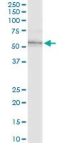 ILK Antibody (4F10), Novus Biologicals 0.1 mg | Buy Online | Novus Biologicals | Fisher Scientific
