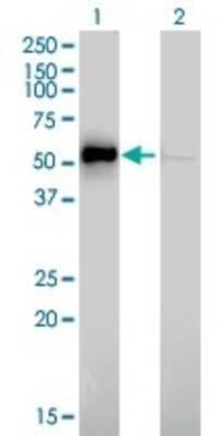 ILK Antibody (4F10), Novus Biologicals 0.1 mg | Buy Online | Novus Biologicals | Fisher Scientific