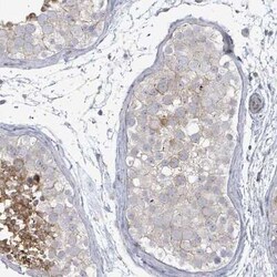 ILT7/CD85g/LILRA4 Antibody, Novus Biologicals:Antibodies:Primary Antibodies