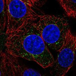 ILVBL Antibody, Novus Biologicals 25 &mu;L, Unconjugated:Antibodies, Polyclonal
