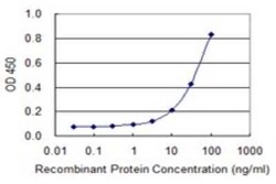 IMP2/IGF2BP2 Antibody (4C6), Novus Biologicals 0.1 mg | Buy Online | Novus Biologicals | Fisher Scientific