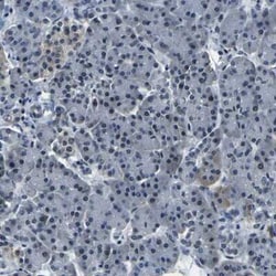 ING2 Antibody, Novus Biologicals:Antibodies:Primary Antibodies