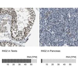 ING2 Antibody, Novus Biologicals:Antibodies:Primary Antibodies