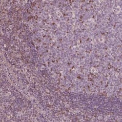 ING3 Antibody, Novus Biologicals 25 &mu;g | Buy Online | Novus Biologicals | Fisher Scientific