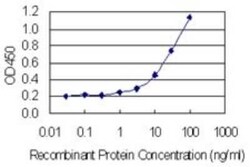 ING4 Antibody (8F7), Novus Biologicals 0.1 mg | Buy Online | Novus Biologicals | Fisher Scientific