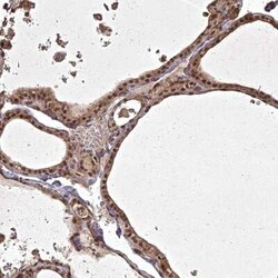 ING5 Antibody, Novus Biologicals:Antibodies:Primary Antibodies