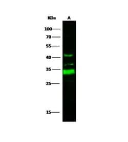 ING5 Antibody, Novus Biologicals 50 &mu;g; Unconjugated:Antibodies, Polyclonal