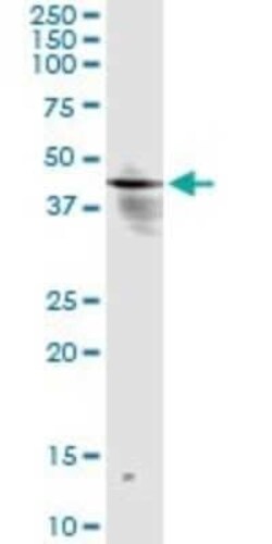 INPP1 Antibody (1A6), Novus Biologicals 0.1 mg | Buy Online | Novus Biologicals | Fisher Scientific