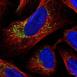 INPP1 Antibody, Novus Biologicals 25 &mu;L, Unconjugated:Antibodies, Polyclonal