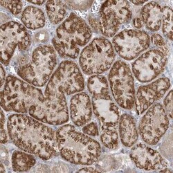INPP1 Antibody, Novus Biologicals 25 &mu;L, Unconjugated:Antibodies, Polyclonal