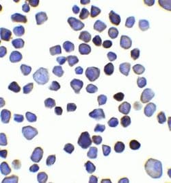 INPP4B Antibody - BSA Free, Novus Biologicals 0.1 mg; Unconjugated:Antibodies,