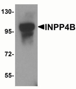 INPP4B Antibody - BSA Free, Novus Biologicals 0.1 mg; Unconjugated:Antibodies,