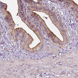 INPP5E Antibody, Novus Biologicals 25 &mu;L, Unconjugated:Antibodies, Polyclonal