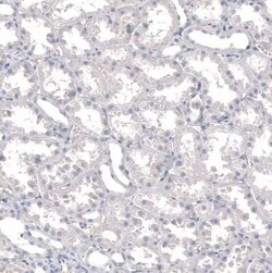 INSM1 Mouse anti-Human, Clone: CL11630, Novus Biologicals 25 &mu;g | Buy Online | Bio-Techne | Fisher Scientific