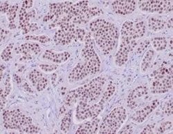 INSM1 Rabbit anti-Human, Clone: INSM1/6286R, Novus Biologicals:Antibodies:Primary