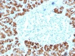 INSM2 Antibody (INSM2/4291) - Azide and BSA Free, Novus Biologicals 100 &mu;g | Buy Online | Novus Biologicals | Fisher Scientific