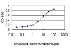 Novus Biologicals INSRR/IR-related receptor Antibody (6E6), Novus Biologicals 0.1 mg | Buy Online | Novus Biologicals&trade; | Fisher Scientific