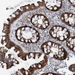 INTU Antibody, Novus Biologicals:Antibodies:Primary Antibodies