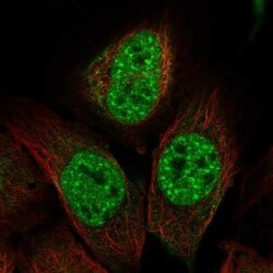 IP3KC Antibody, Novus Biologicals 25 &mu;L, Unconjugated:Antibodies, Polyclonal