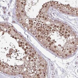 IP3KC Antibody, Novus Biologicals 25 &mu;L, Unconjugated:Antibodies, Polyclonal