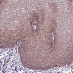 IP3KC Antibody, Novus Biologicals:Antibodies:Primary Antibodies