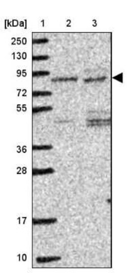IP3KC Antibody, Novus Biologicals 25 &mu;L, Unconjugated:Antibodies, Polyclonal