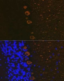 IP3R1 Rabbit anti-Mouse, Rat, Clone: 4Z1B6, Novus Biologicals:Antibodies:Primary