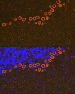 IP3R1 Rabbit anti-Mouse, Rat, Clone: 4Z1B6, Novus Biologicals:Antibodies:Primary