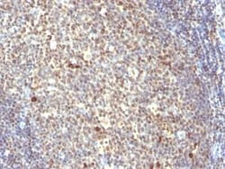 IPO-38 Antibody (IPO-38), Novus Biologicals:Antibodies:Primary Antibodies