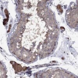 IPP Rabbit anti-Human, Polyclonal, Novus Biologicals 25 &mu;g; Unconjugated:Antibodies,