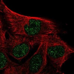 IQCD Antibody, Novus Biologicals 25 &mu;L, Unconjugated:Antibodies, Polyclonal