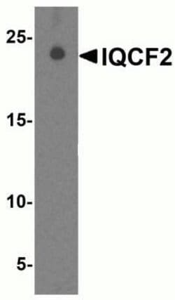 IQCF2 Antibody - BSA Free, Novus Biologicals 0.1 mg | Buy Online | Novus Biologicals | Fisher Scientific