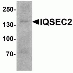 IQSEC2 Antibody - BSA Free, Novus Biologicals 0.1 mg | Buy Online | Novus Biologicals | Fisher Scientific