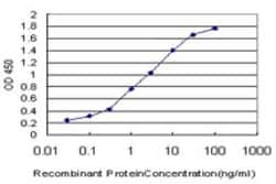 Novus Biologicals IRAK1 Antibody (3F7), Novus Biologicals 0.1 mg | Buy Online | Novus Biologicals&trade; | Fisher Scientific