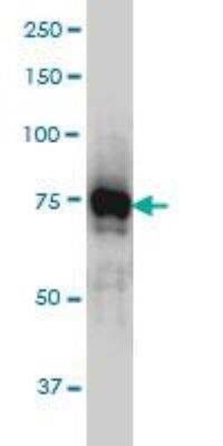 Novus Biologicals IRAK1 Antibody (3F7), Novus Biologicals 0.1 mg | Buy Online | Novus Biologicals&trade; | Fisher Scientific
