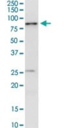 IRAK3 Antibody (1C9), Novus Biologicals 0.1 mg | Buy Online | Novus Biologicals | Fisher Scientific