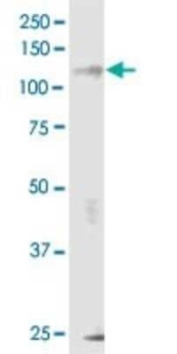 IRE1 alpha Antibody (8D12), Novus Biologicals 0.1 mg | Buy Online | Novus Biologicals | Fisher Scientific