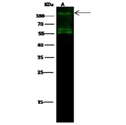 IRE1 alpha Antibody, Novus Biologicals:Anticuerpos:Anticuerpos primarios