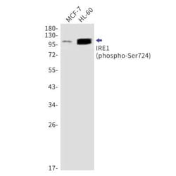 IRE1 alpha Rabbit anti-Human, Clone: S05-6E7, Novus Biologicals 25 &mu;g;