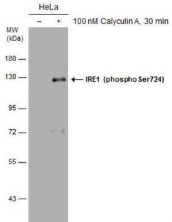 IRE1 alpha, p Ser724 Antibody, Novus Biologicals 100 &mu;g; Unconjugated:Antibodies,