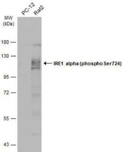 IRE1 alpha, p Ser724 Antibody, Novus Biologicals 100 &mu;g | Buy Online | Novus Biologicals | Fisher Scientific