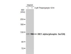 IRE1 alpha, p Ser724 Antibody, Novus Biologicals 100 &mu;g | Buy Online | Novus Biologicals | Fisher Scientific