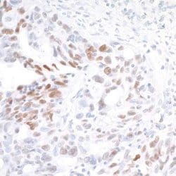 IRF1 Antibody (BLR039F), Novus Biologicals 100 &mu;L | Buy Online | Novus Biologicals | Fisher Scientific