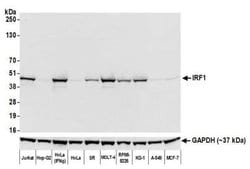 IRF1 Antibody (BLR039F), Novus Biologicals 100 &mu;L | Buy Online | Novus Biologicals | Fisher Scientific