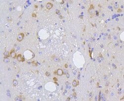 IRF1 Antibody (SR44-08), Novus Biologicals 100&mu;L:Antibodies, Monoclonal